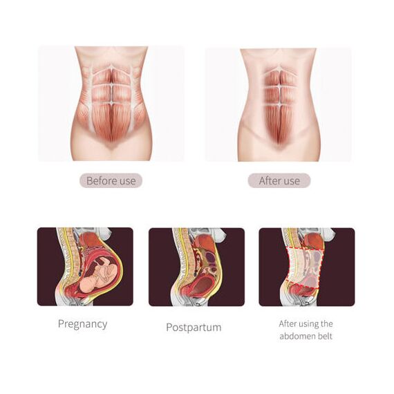 Sunveno Breathable Postpartum Abdominal Belt, Color: Blue, Maternity Size: M, 8 image