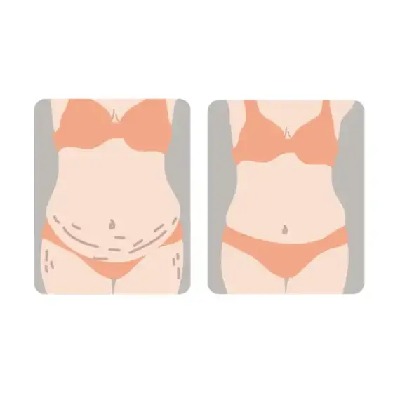 Sunveno Breathable Postpartum Abdominal Belt, Color: White, Maternity Size: XL, 13 image