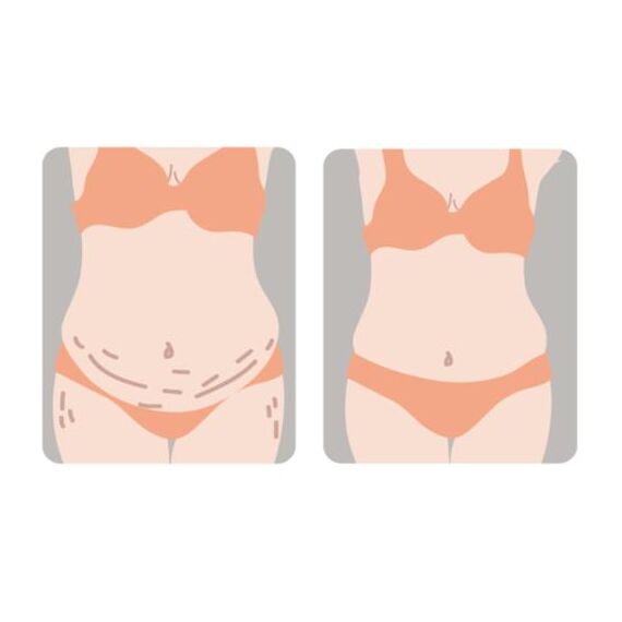 Sunveno Breathable Postpartum Abdominal Belt, Color: White, Maternity Size: L, 13 image